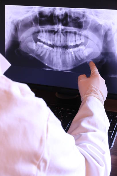 Best Teeth Whitening  in Flat Rock, MI