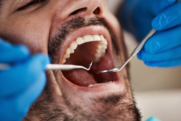 Best Knocked-Out Tooth Emergency  in Flat Rock, MI
