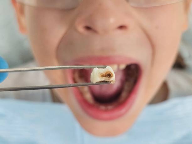 Best Broken Tooth Emergency  in Flat Rock, MI